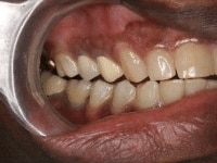 Konig Center for Cosmetic & Comprehensive Dentistry smile photos